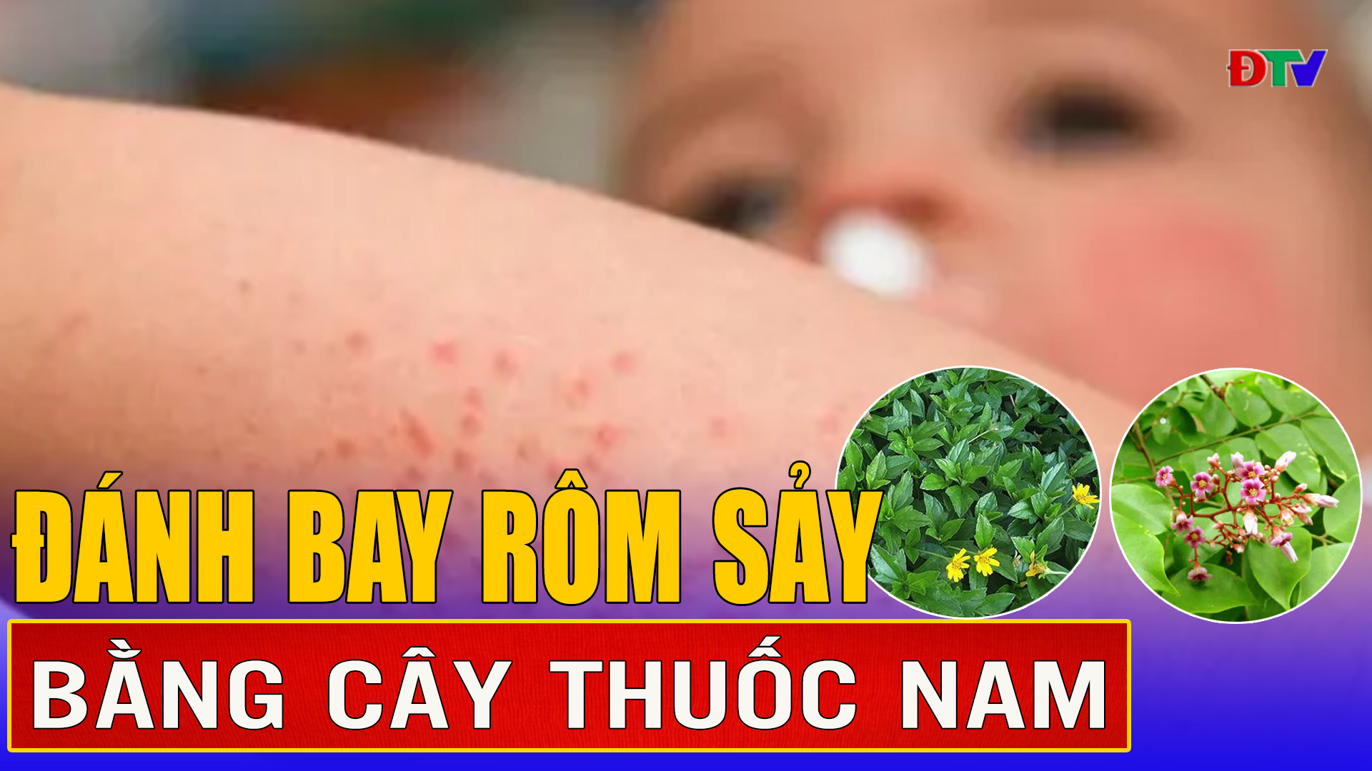 Đánh bay rôm sảy bằng cây thuốc nam
