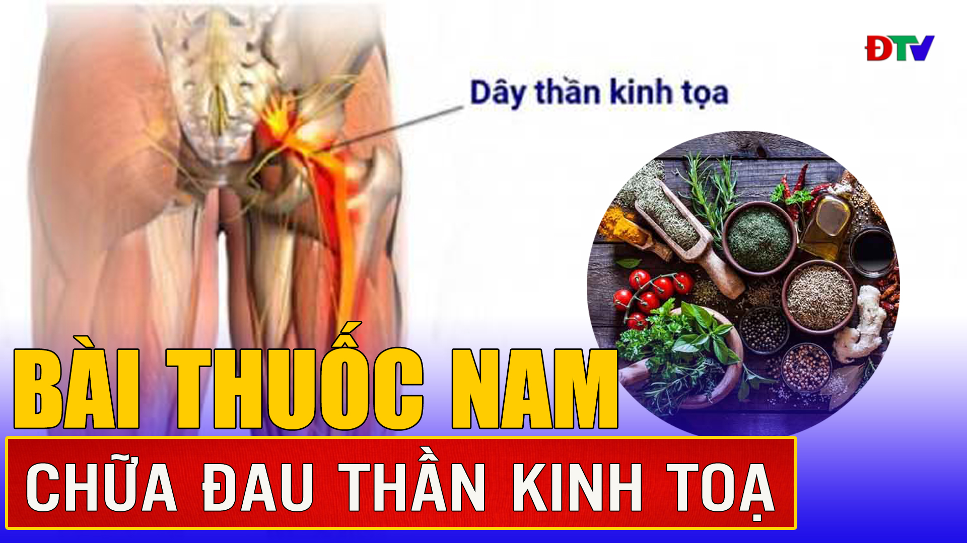 Bài thuốc nam chữa đau thần kinh tọa